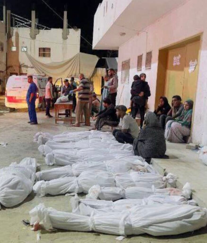 Israel’s airstrikes on Gaza: 73 dead